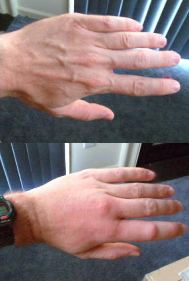 An ugly sting ends a beautiful relationship>>>